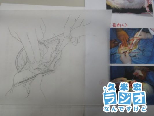 手術のポイントを示したイラスト