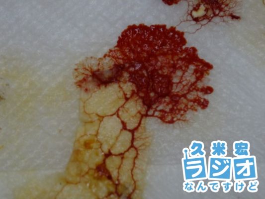 変形菌
